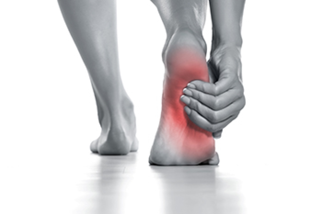 Reasons for Pain in the Arch of the Foot
