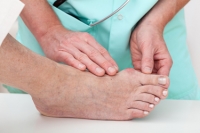 How Podiatrists Treat Bunions