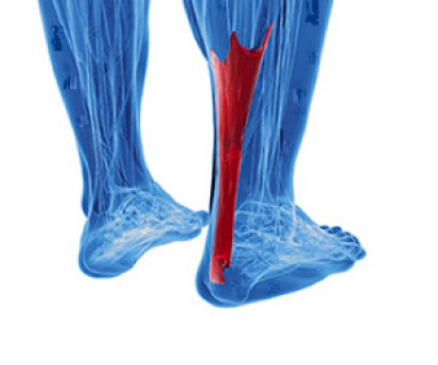 Symptoms Causes and Effective Treatment for an Achilles Tendon Injury